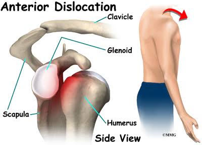 Anterior Humeral Glide Fix session thumbnail