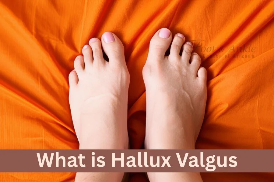 Bunion / Hallux Valgus Guide session thumbnail