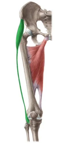 Elevated side Tensor Fascia Latae (TFL)