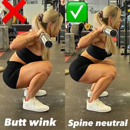 Excessive Posterior Pelvic Tilt