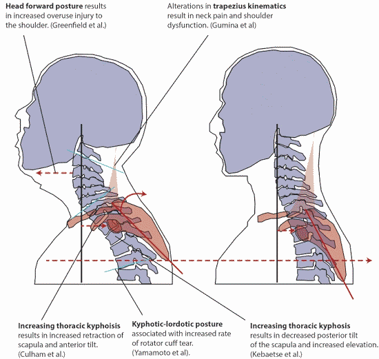Scapular Anterior Tilt