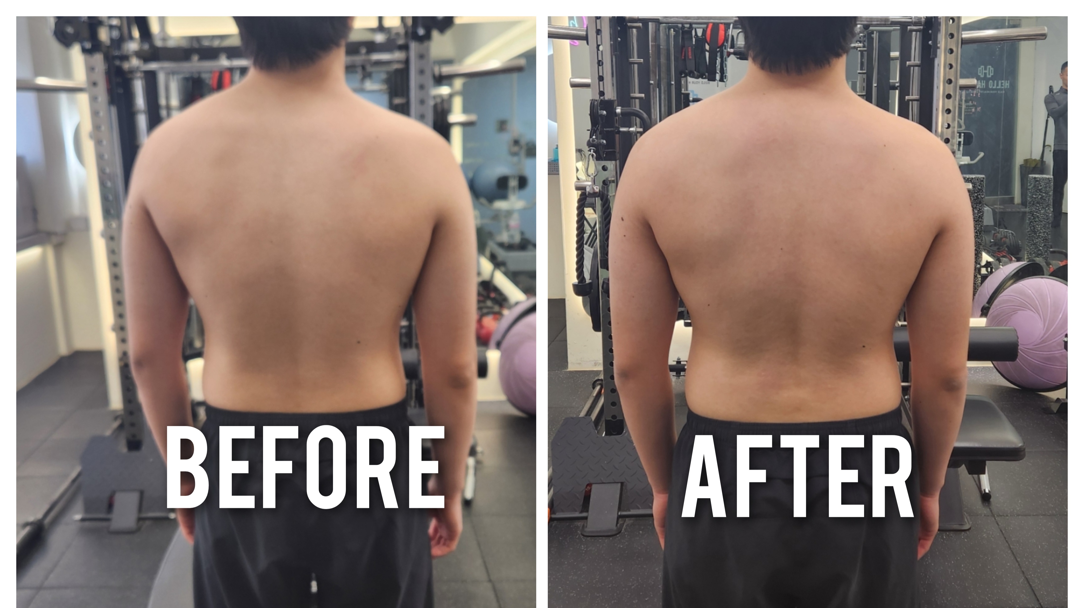 Shoulder Elevation